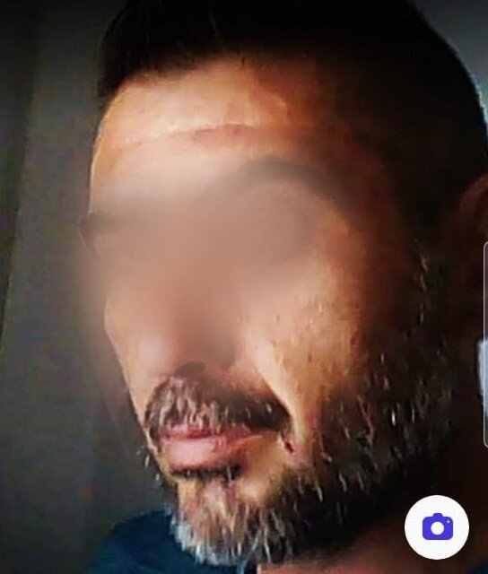 Αυτός είναι ο 48χρονος που ξυλοκόπησε άγρια τη 40χρονη σύντροφό του