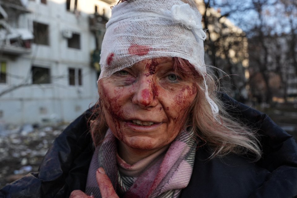 Μια τραυματισμένη γυναίκα από αεροπορική επιδρομή έξω από το Χάρκοβο, σήμερα