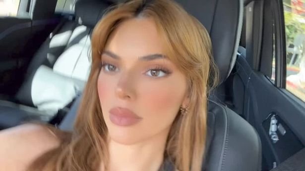 H Κένταλ Τζένερ φούσκωσε τα χείλη της