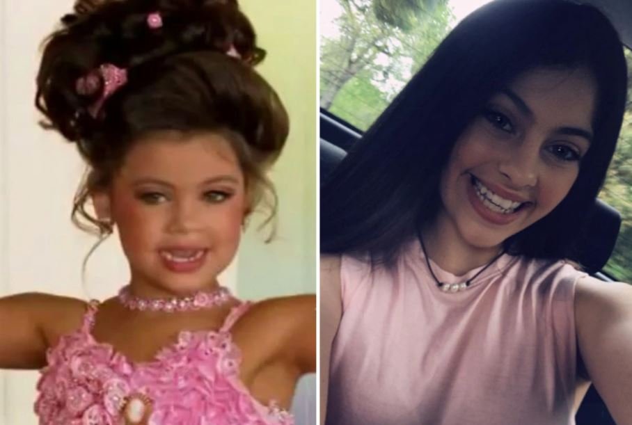 Η Makenzie δεν ήταν οπαδός των extensions μαλλιών ή των ψεύτικων βλεφαρίδων, γεγονός που την οδήγησε σε ξεσπάσματα