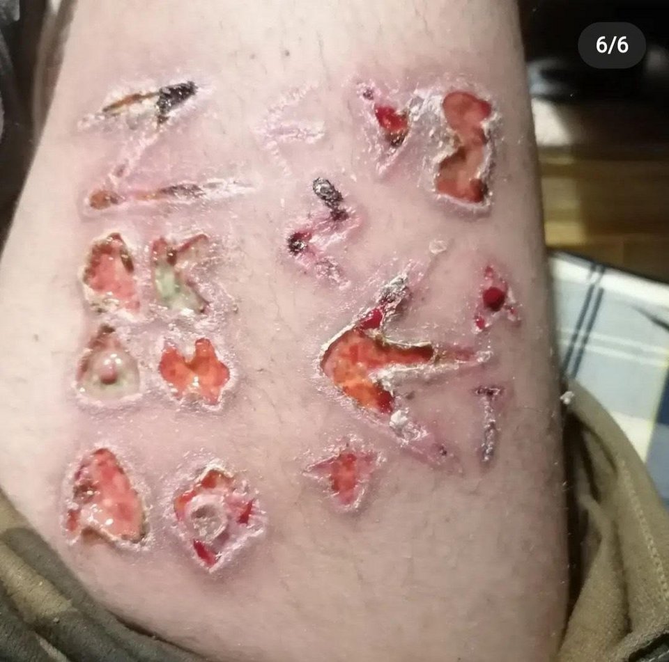 Στα social media έχει ανεβάσει και φωτογραφία που φαίνεται να έχει χαράξει κάποια σύμβολα και τη λέξη Ζευς στο πόδι του.