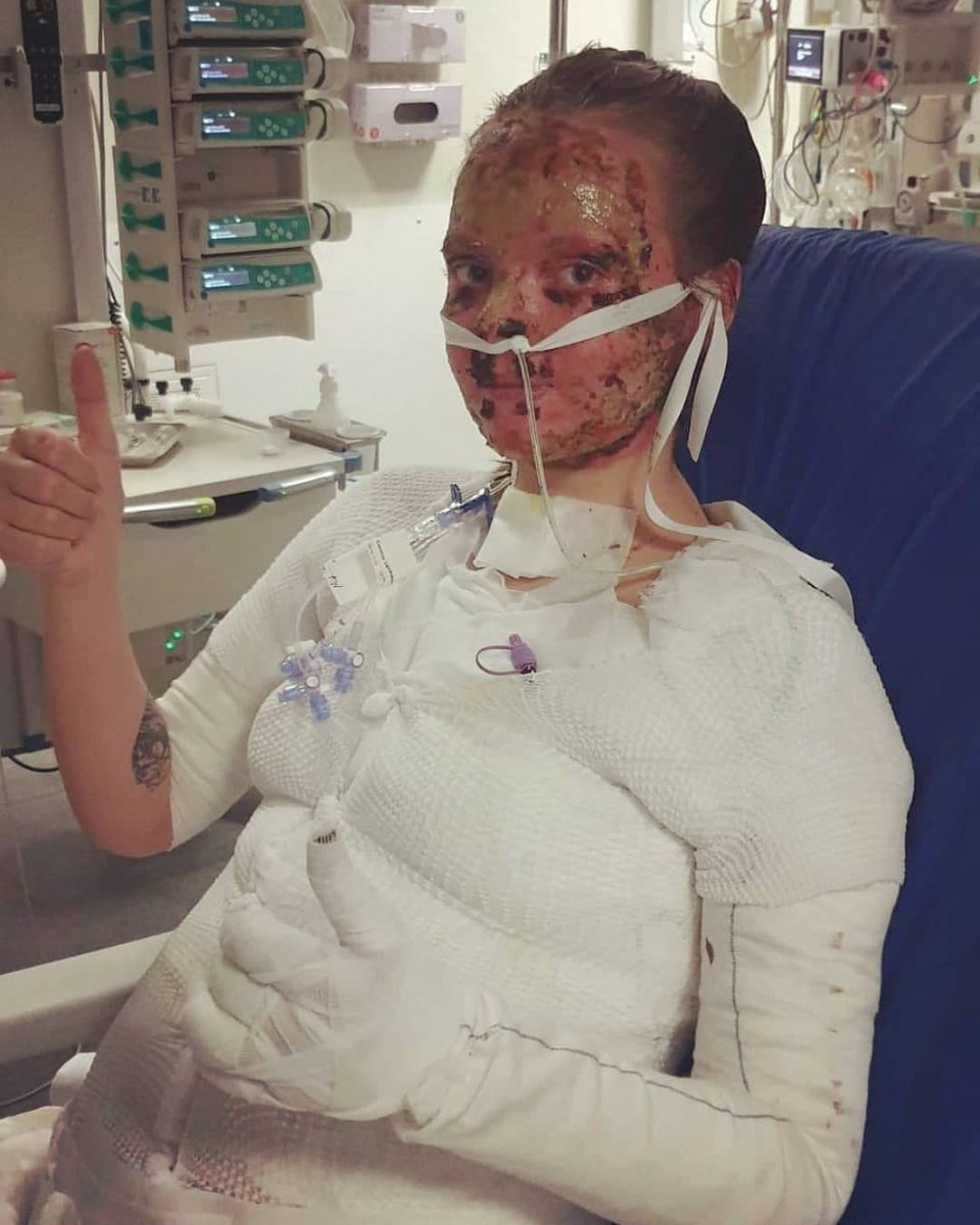 Η 24χρονη στο νοσοκομείο