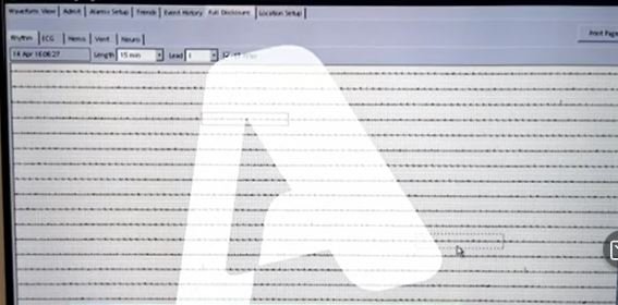 Ντοκουμέντα από τη νοσηλεία της Τζωρτζίνας