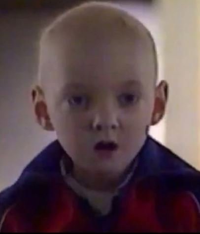 άρρωστο παιδάκι από το Τσερνόμπιλ