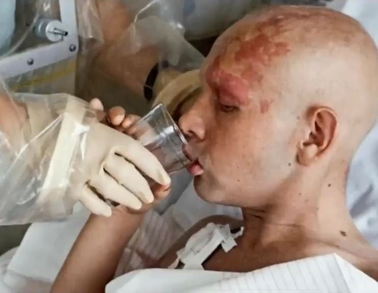 Ένας άνδρας πίνει νερό σε ένα νοσοκομειακό κρεβάτι με τη βοήθεια μιας νοσοκόμας στο Τσερνόμπιλ