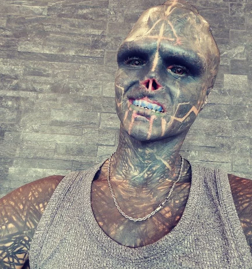 Το άνω χείλος του έχει επίσης αφαιρεθεί σχεδόν τελείως, γεγονός που τον δυσκολεύει να μιλήσει