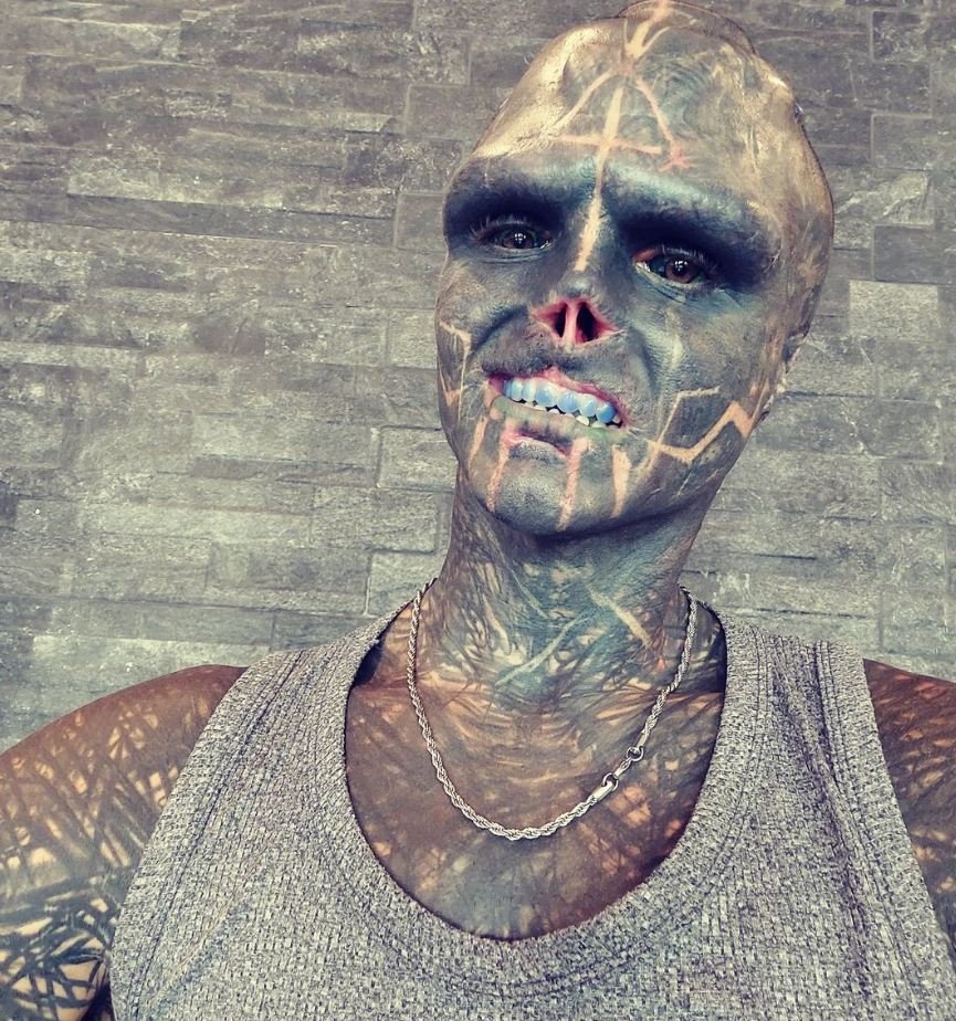 Το άνω χείλος του έχει επίσης αφαιρεθεί σχεδόν τελείως, γεγονός που τον δυσκολεύει να μιλήσει