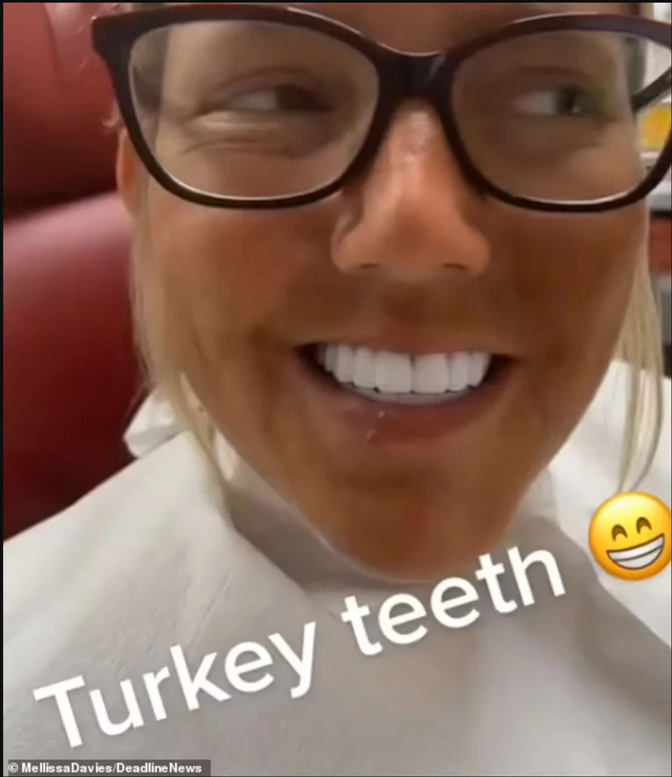 Σάλος με τα «δόντια Τουρκίας»: 35χρονη πήγε να φτιάξει χαμόγελο και περιγράφει τη φρίκη μόλις ξύπνησε