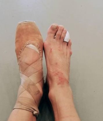 Τα πόδια της Ελευθερίας Στάμου μετά τις πρόβες