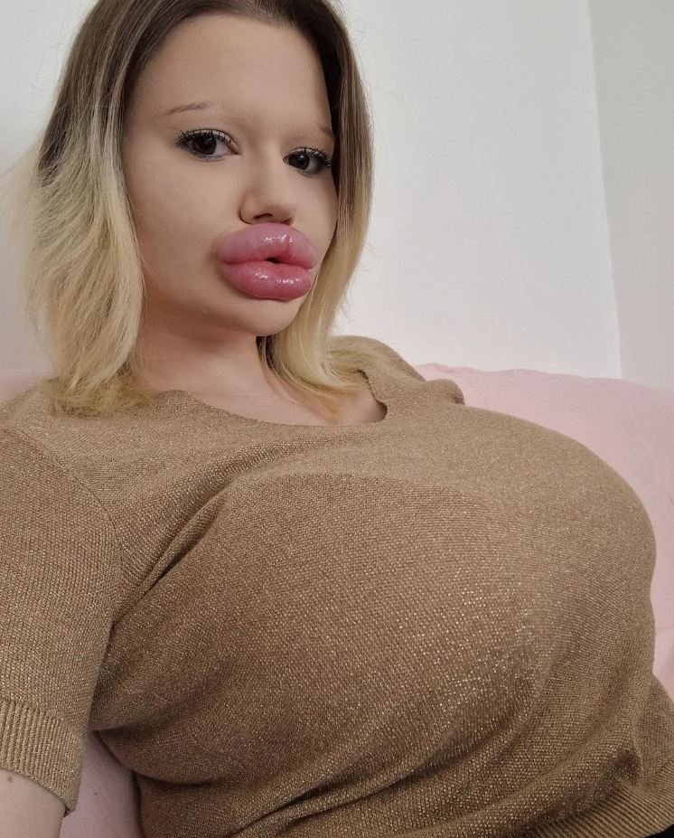  Η Andrea έχει κάνει και αυξητική στήθους