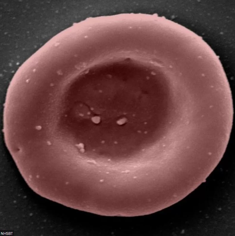 Ένα εργαστηριακά παραγόμενο ερυθρό αιμοσφαίριο, το οποίο μεταφέρει οξυγόνο και διοξείδιο του άνθρακα στο σώμα