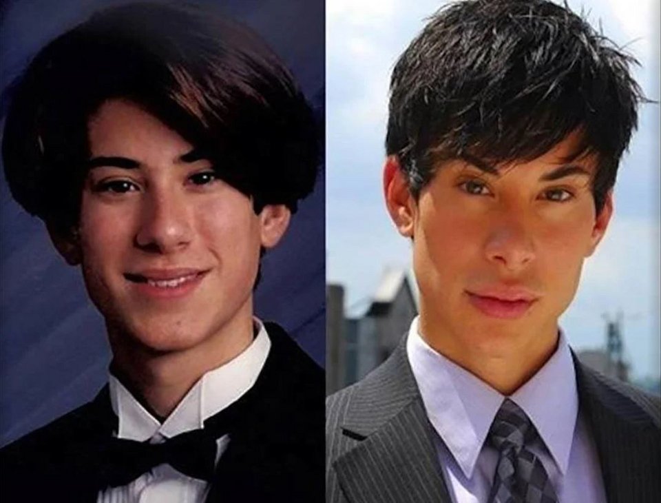 O Jedlica πώς ήταν πριν και πώς τώρα