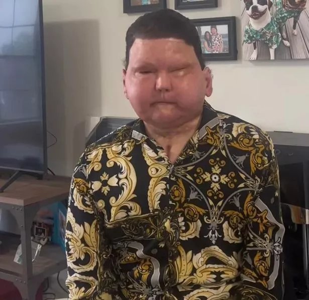 Ο Τζο βρίσκεται ακόμα στο μακρύ δρόμο της ανάρρωσης 