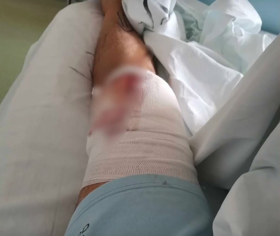 Η αδέσποτη σφαίρα τον βρήκε πάνω από το γόνατο