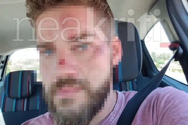 Ο ξεναγός που κατήγγειλε τον ξυλοδαρμό του /neakriti.gr