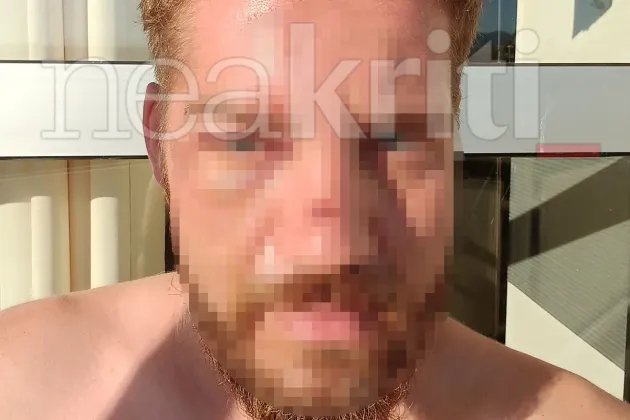 Ο ξεναγός που κατήγγειλε τον ξυλοδαρμό του /neakriti.gr