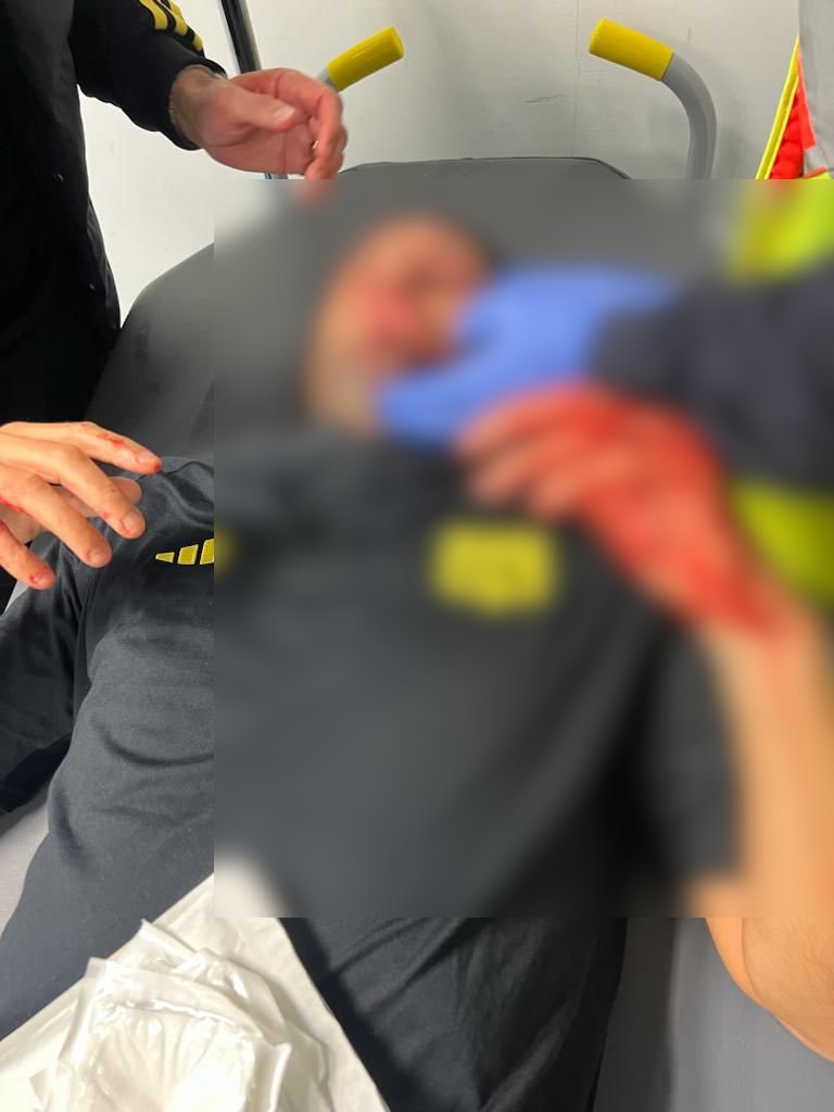Ο Φάμπιο Γκρόσο τραυματισμένος μετά την επίθεση στο πούλμαν της ομάδας / Φωτογραφία: X