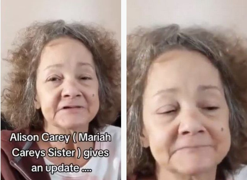 Η αδερφή της Mariah Carey αποκαλύπτει ότι έχει χάσει όλα της τα δόντια