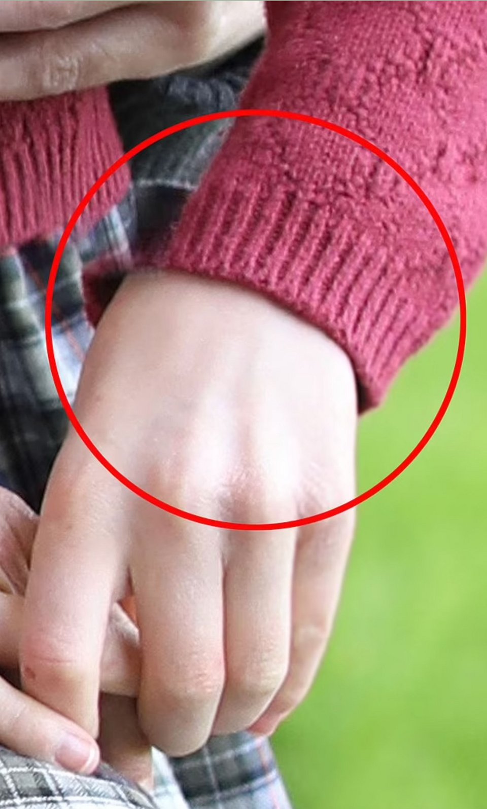 Κέιτ Μίντλετον: Reuters και άλλα πρακτορεία αποσύρουν την φωτό της ως «πειραγμένη» -Το εξώφθαλμο photoshop