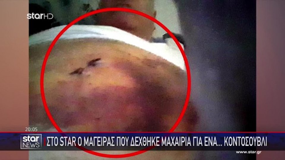 Τα σημάδια της επίθεσης με μαχαίρι που δέχτηκε ο 65χρονος μάγειρας / Φωτογραφία Star