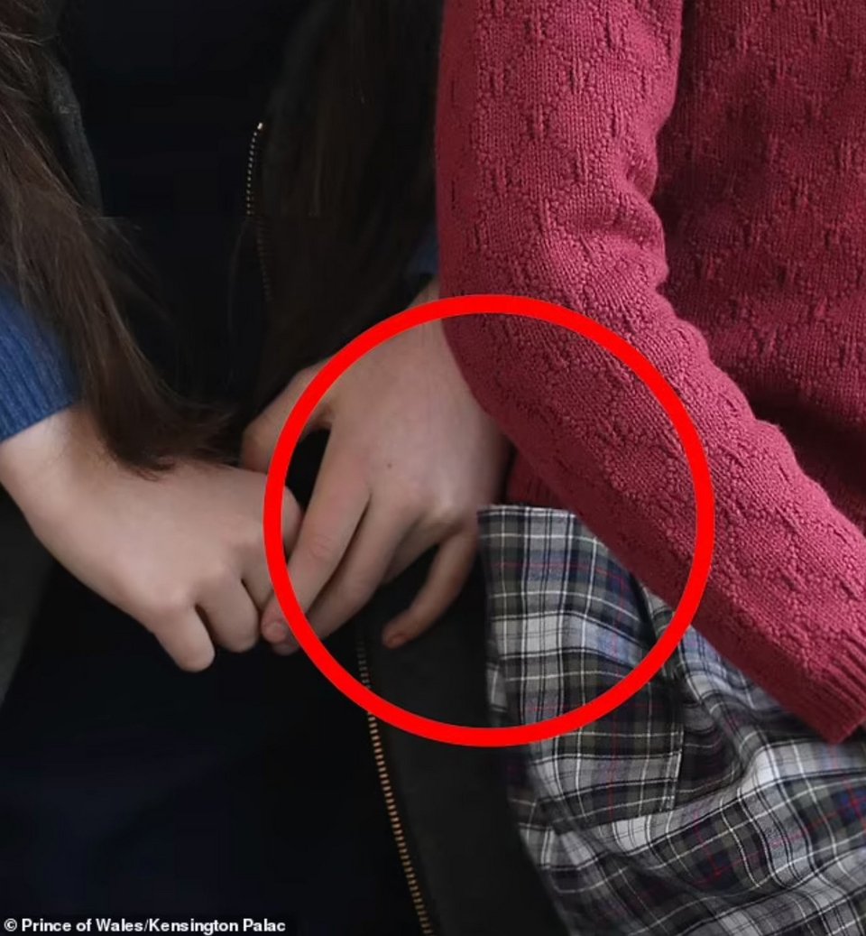 To εξώφθαλμο photoshop στη φωτογραφία της Κέιτ Μίντλετον