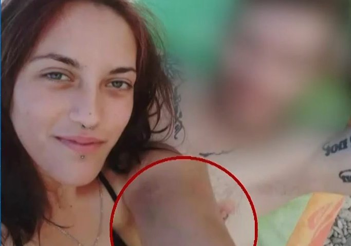 Άγιοι Ανάργυροι, μελανιά