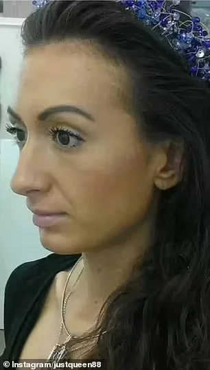 Η Anastasia Pokreschchuk, στα 26 της πριν τις πλαστικές επεμβάσεις