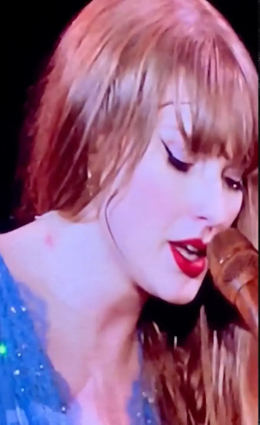 H σημάδι στο λαιμό της Τέιλορ Σουίφτ