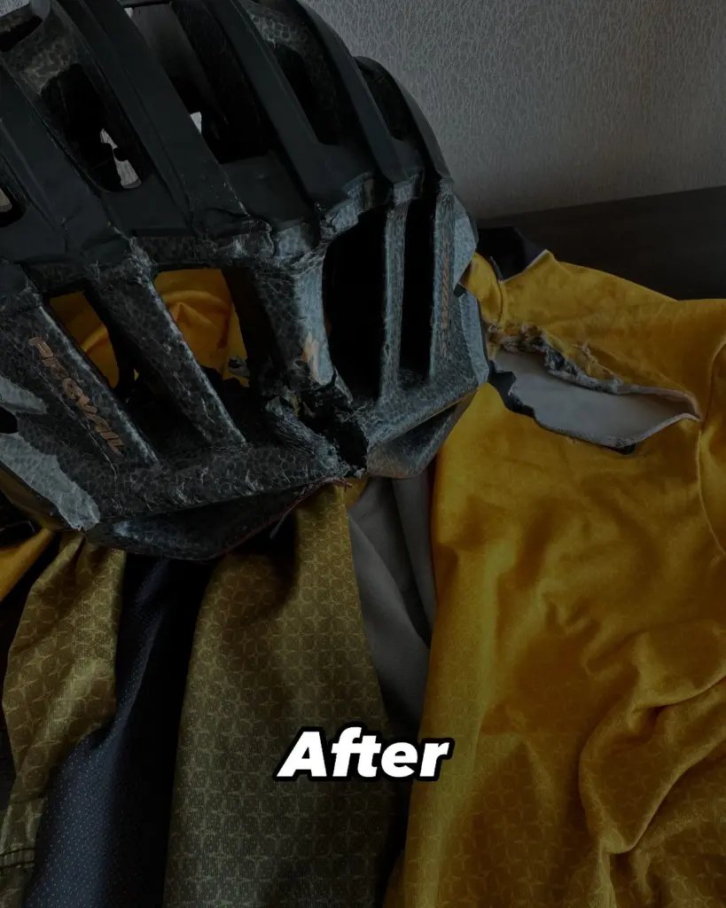 Τα ρούχα και το κράνος του μετά το ατύχημα με το ποδήλατο 