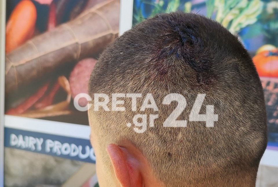Τα τραύματα του 32χρονου γιου από την επίθεση στο μίνι μάρκετ / creta24.gr