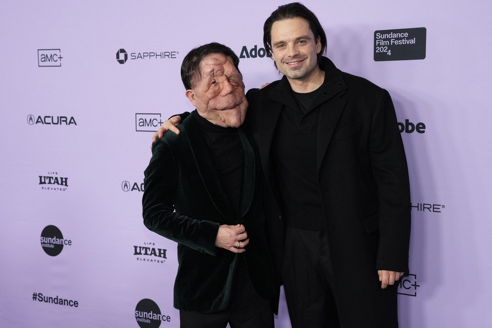 Ο Adam Pearson, αριστερά, και ο Sebastian Stan στην πρεμιέρα του "A Different Man" στο Eccles Theatre κατά τη διάρκεια του Φεστιβάλ Κινηματογράφου Sundance