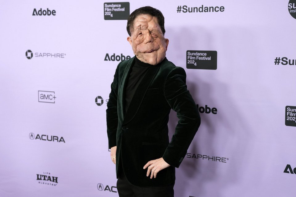 Ο Adam Pearson στην πρεμιέρα του "A Different Man" στο Eccles Theatre