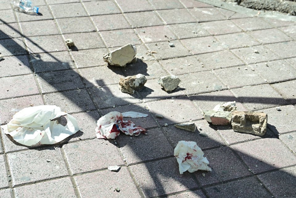 Οι σοβάδες που έπεσαν στο κεφάλι της ανήλικης