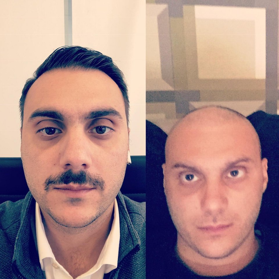 Ο Κωνσταντίνος Ράικος. Η δεξιά φωτό κατά τη διάρκεια των χημειοθεραπειών του