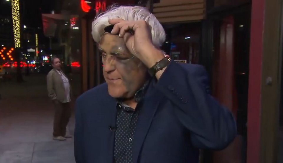 O Τζέι Λένο έβγαλε το κάλυμμα και αποκάλυψε το πρησμένο μάτι του