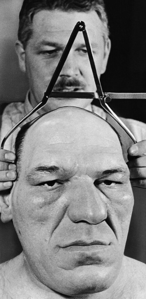 Ο Δρ. Carleton Coon μετρά το κεφάλι του Maurice Tillet, 23 Φεβρουαρίου 1940