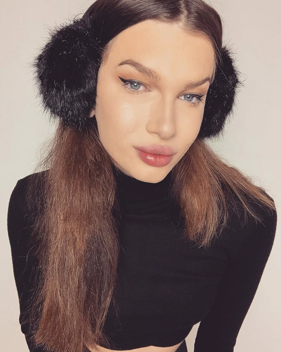 Η Ζολέν πριν κάνει τις αισθητικές επεμβάσεις