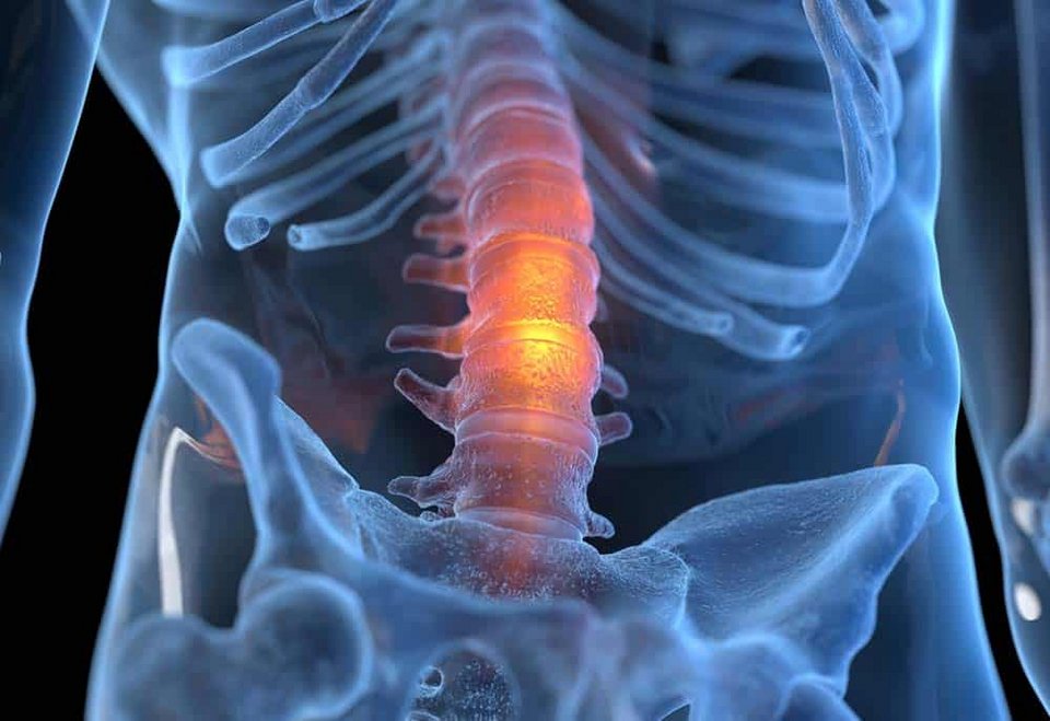Η οσφυαλγία είναι ένα από τα συνηθέστερα προβλήματα υγείας σε όλο τον κόσμο / SHUTTERSTOCK