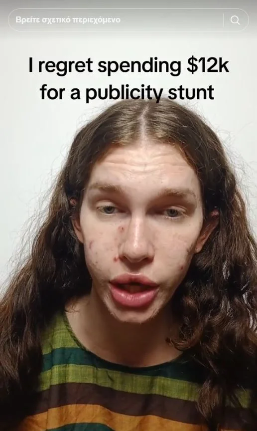 H Τζολέν όταν το πρόσωπό της απέρριψε το filler