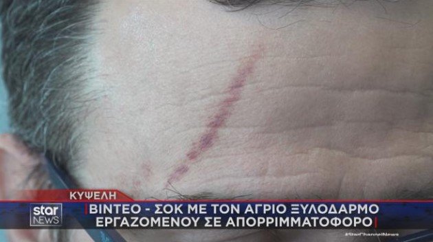 Με σημάδια στο μέτωπο ο 49χρονος εργαζόμενος καθαριότητας, πατέρας ενός παιδιού