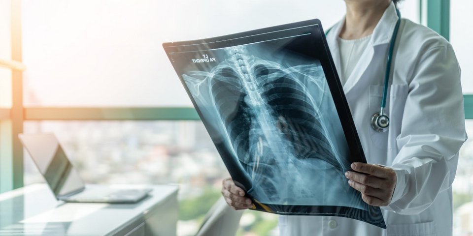 Γιατρός εξετάζει ακτινογραφία / Φωτογραφία: Shutterstock