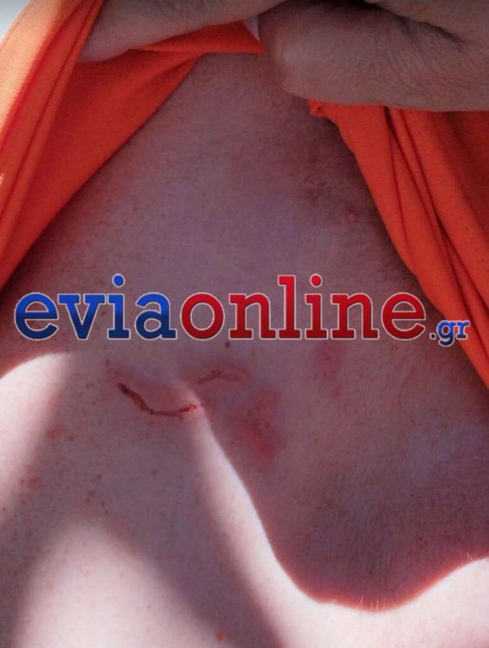 Μεγάλη έξαρση παρουσιάζουν φέτος το καλοκαίρι στα ελληνικά νερά οι μωβ μέδουσες