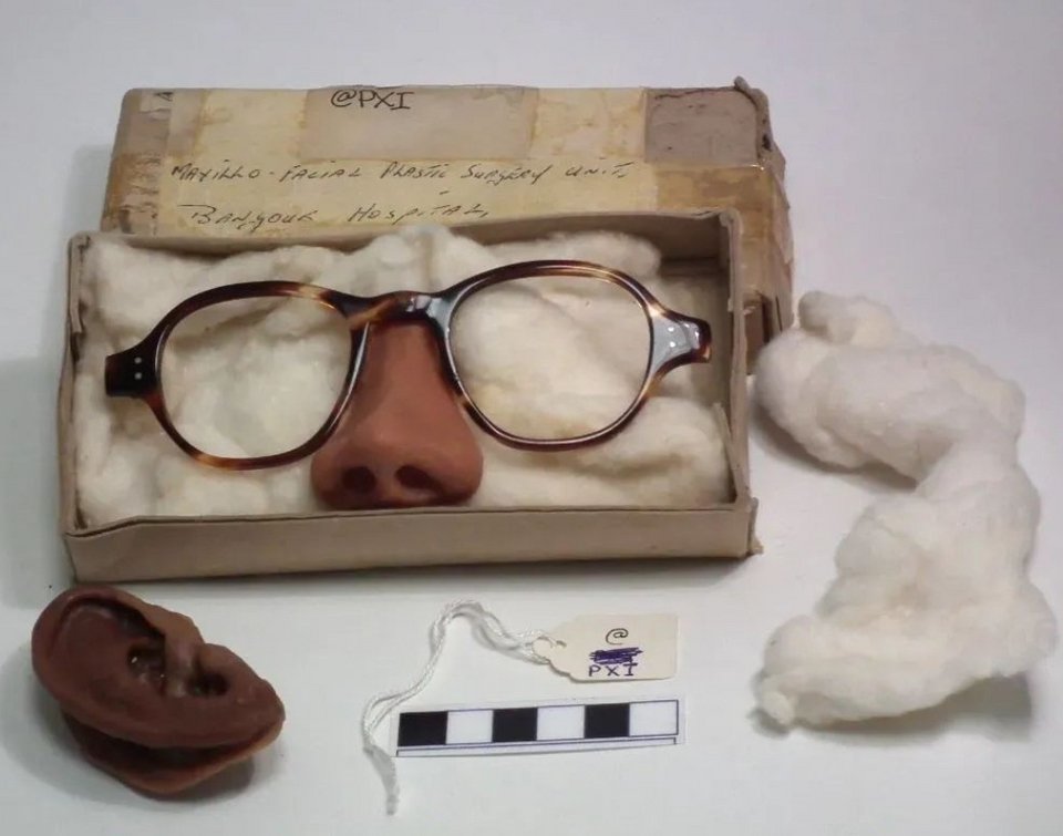 Προσθετικό αυτί και μύτη από τα μέσα του 20ού αιώνα, τα οποία κατασκευάστηκαν για ασθενή