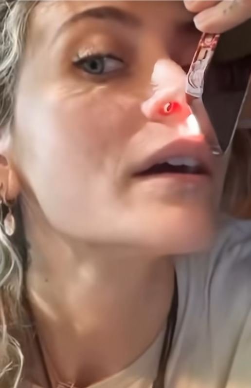 Η τρύπα στο εσωτερικό της μύτης της Πάρις Τζάκσον 