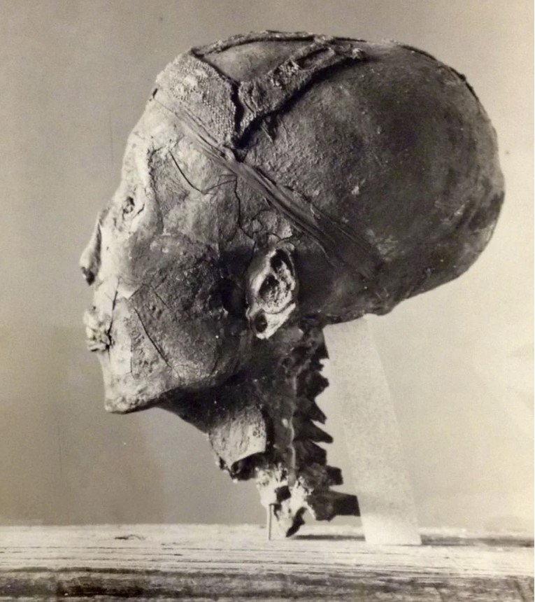 Το 1925, όταν πλέον η αρχική έκσταση της ανακάλυψης είχε δώσει τη θέση της στη μεθοδική εκκαθάριση του θαλάμου, οι συντηρητές ήρθαν αντιμέτωποι με το σώμα του Τουταγχαμών / WIKIPEDIA