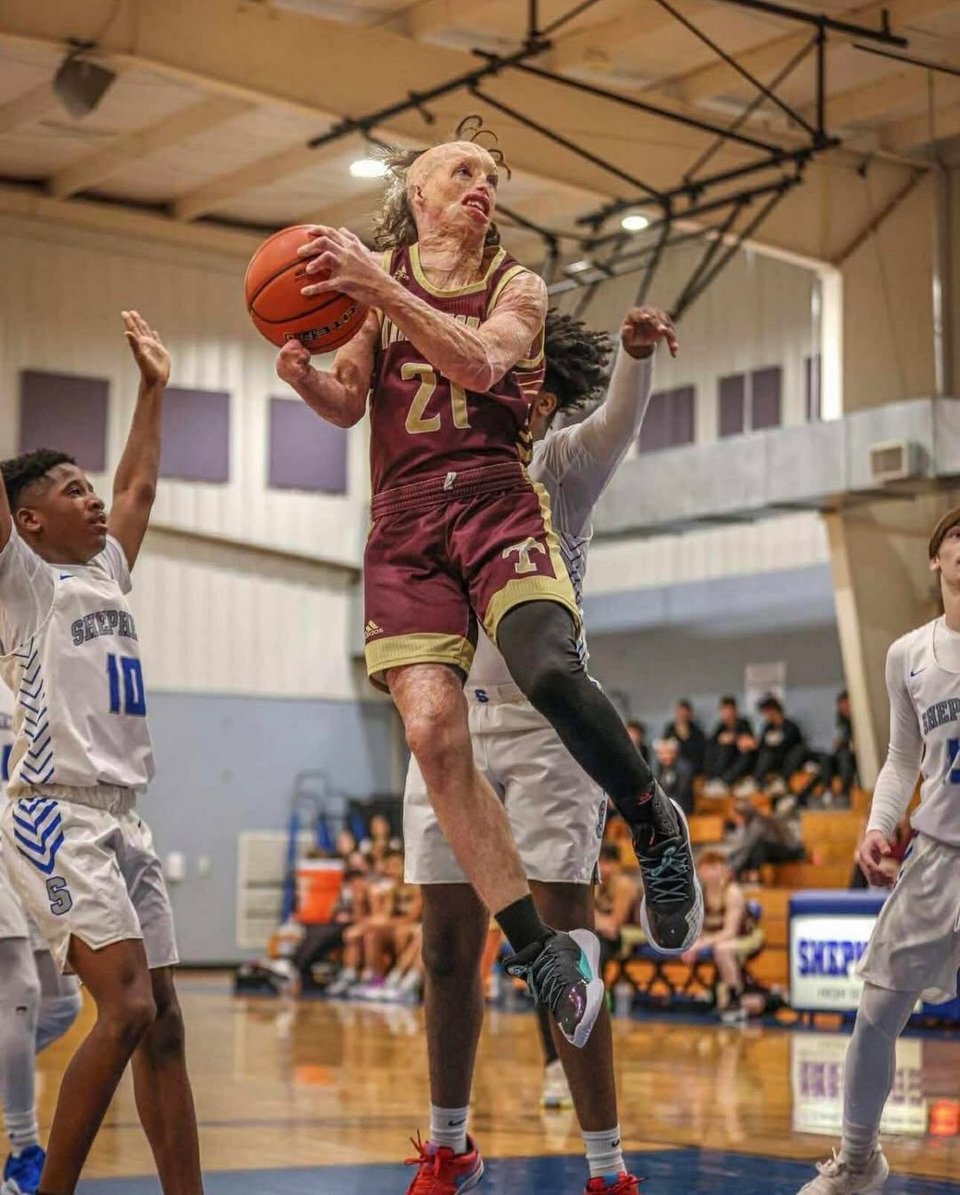 Ο Ντίλαν, παρά τις δυσκολίες, παίζει μπάσκετ 