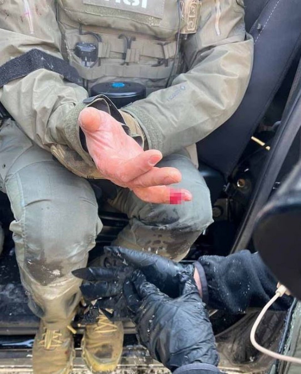 Τραυματισμένος αστυνομικός