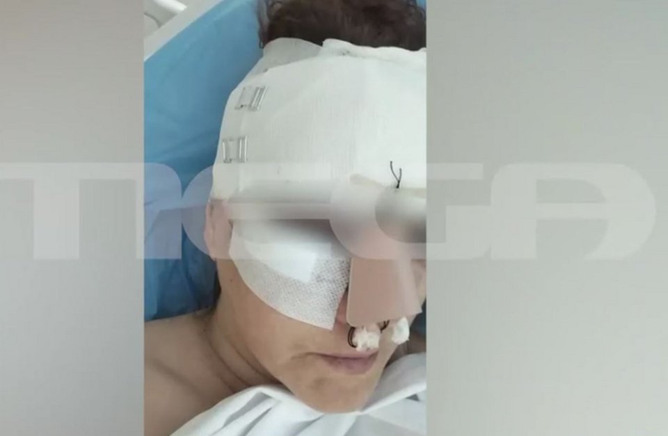 Η 45χρονη που τραυματίστηκε από την πτώση οροφής σε κατάστημα στη Θεσσαλονίκη / MEGA / Glomex