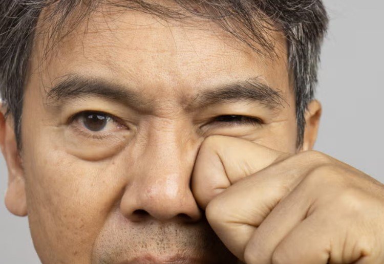 Πρόκειται για ένα φαινόμενο που, σύμφωνα με επιστημονικά δεδομένα, επηρεάζει περίπου το 70% του πληθυσμού σε κάποια φάση της ζωής του. Παρότι συχνά προκαλεί ανησυχία, στις περισσότερες περιπτώσεις δεν αποτελεί ένδειξη σοβαρής πάθησης, αλλά μια φυσιολογική αντίδραση του σώματος σε καθημερινούς παράγοντες / SHUTTERSTOCK