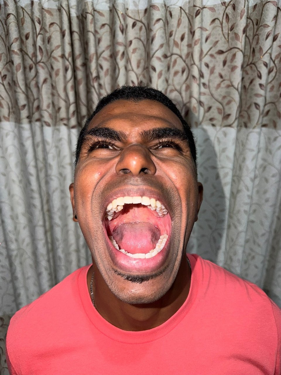 Ένας 33χρονος από τη Μαλαισία κατέκτησε μια ασυνήθιστη θέση στο βιβλίο των παγκόσμιων ρεκόρ, καθώς διαθέτει συνολικά 42 δόντια — δέκα περισσότερα από τον μέσο αριθμό που συναντάται στους ενήλικες ανθρώπους / FACEBOOK